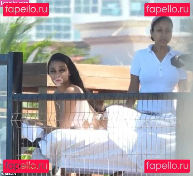 Winnie Harlow Onlyfans Photo Gallery 