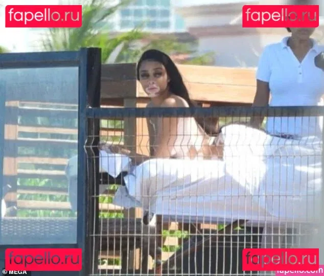 Winnie Harlow Onlyfans Photo Gallery 