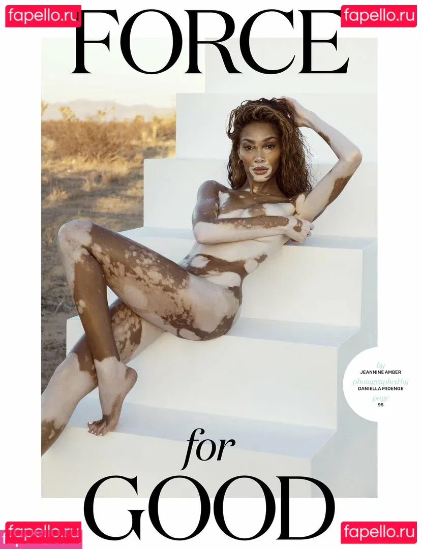 Winnie Harlow Onlyfans Photo Gallery 