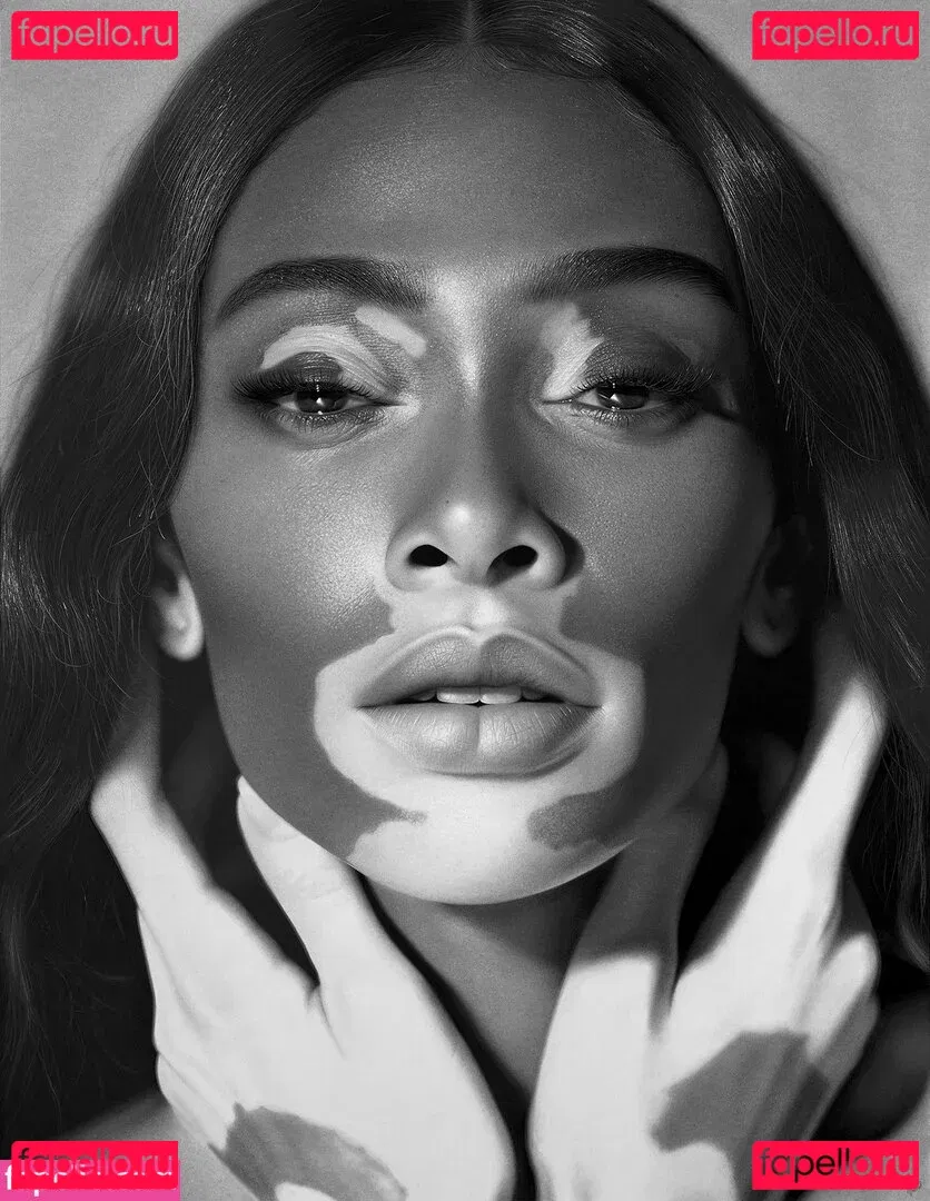 Winnie Harlow Onlyfans Photo Gallery 