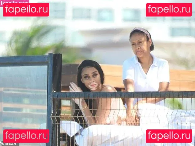 Winnie Harlow Onlyfans Photo Gallery 