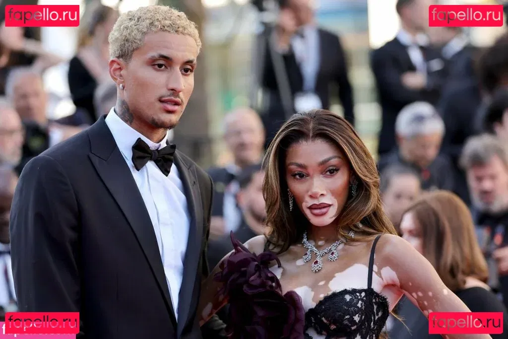 Winnie Harlow Onlyfans Photo Gallery 