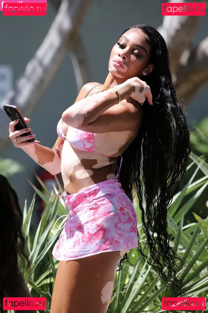 Winnie Harlow Onlyfans Photo Gallery 