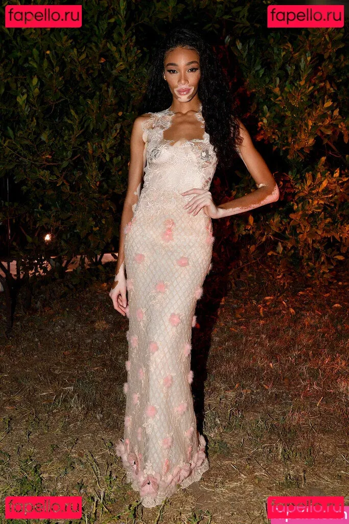 Winnie Harlow Onlyfans Photo Gallery 