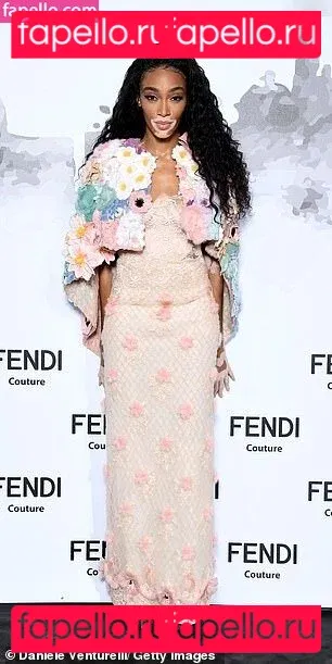 Winnie Harlow Onlyfans Photo Gallery 