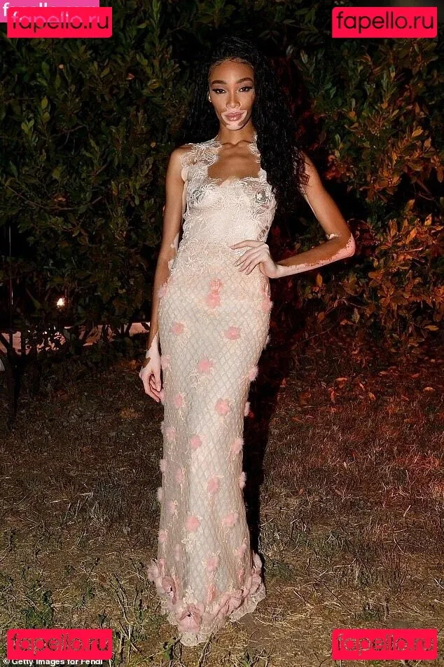 Winnie Harlow Onlyfans Photo Gallery 