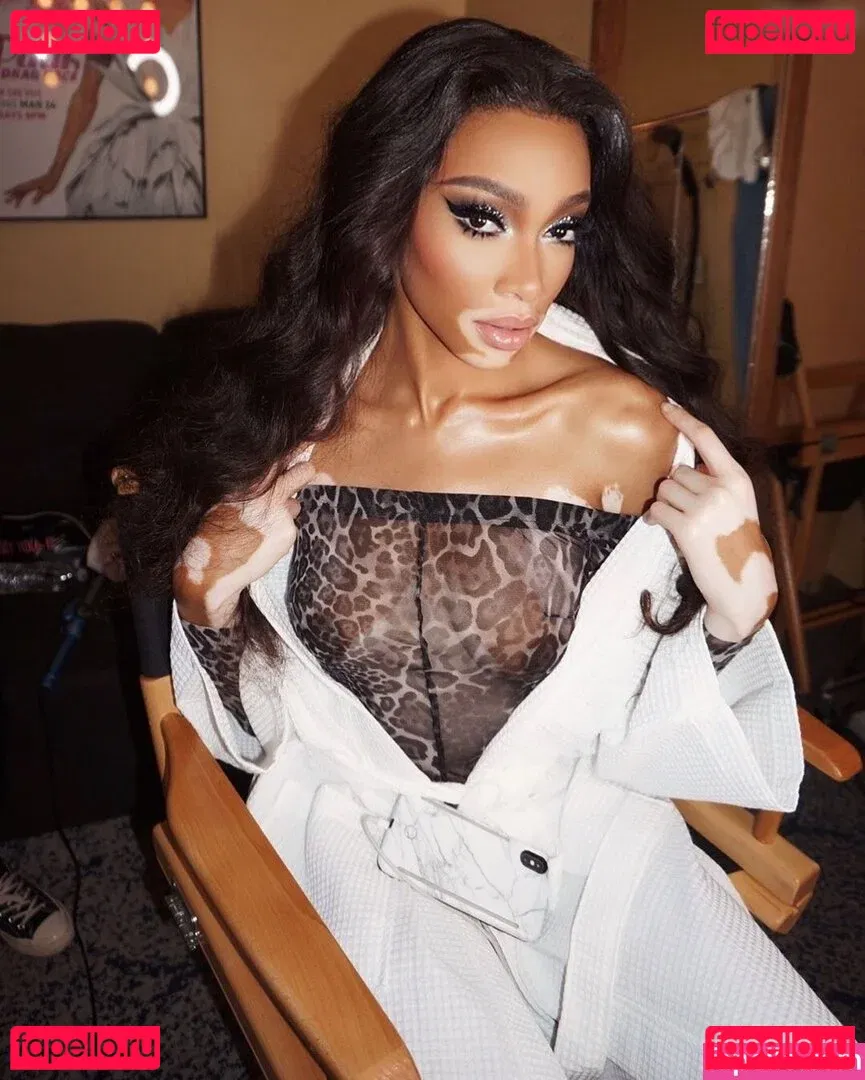 Winnie Harlow Onlyfans Photo Gallery 