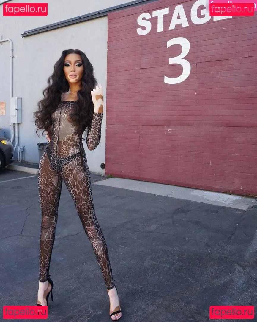 Winnie Harlow Onlyfans Photo Gallery 