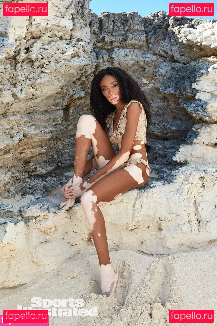 Winnie Harlow Onlyfans Photo Gallery 