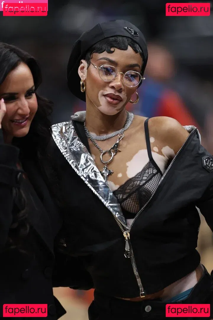 Winnie Harlow Onlyfans Photo Gallery 