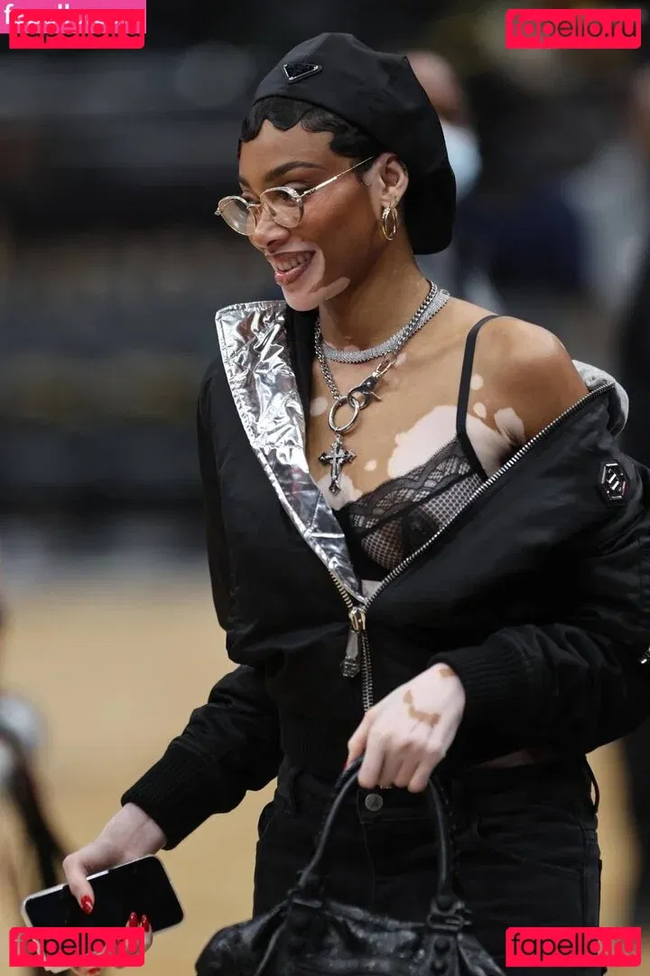 Winnie Harlow Onlyfans Photo Gallery 