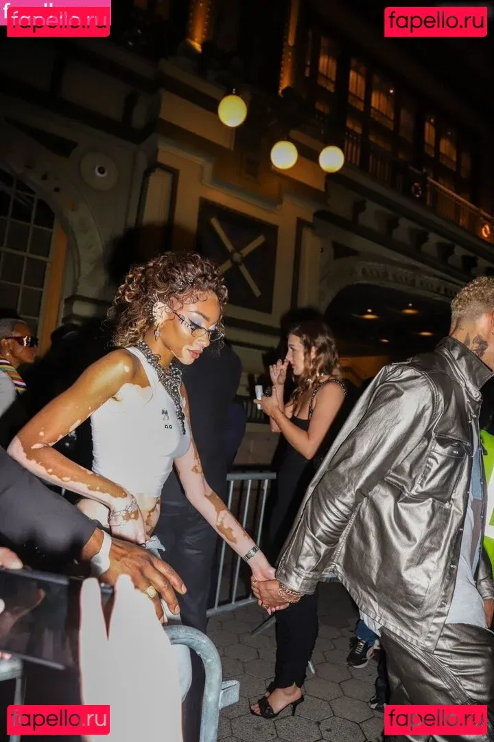 Winnie Harlow Onlyfans Photo Gallery 