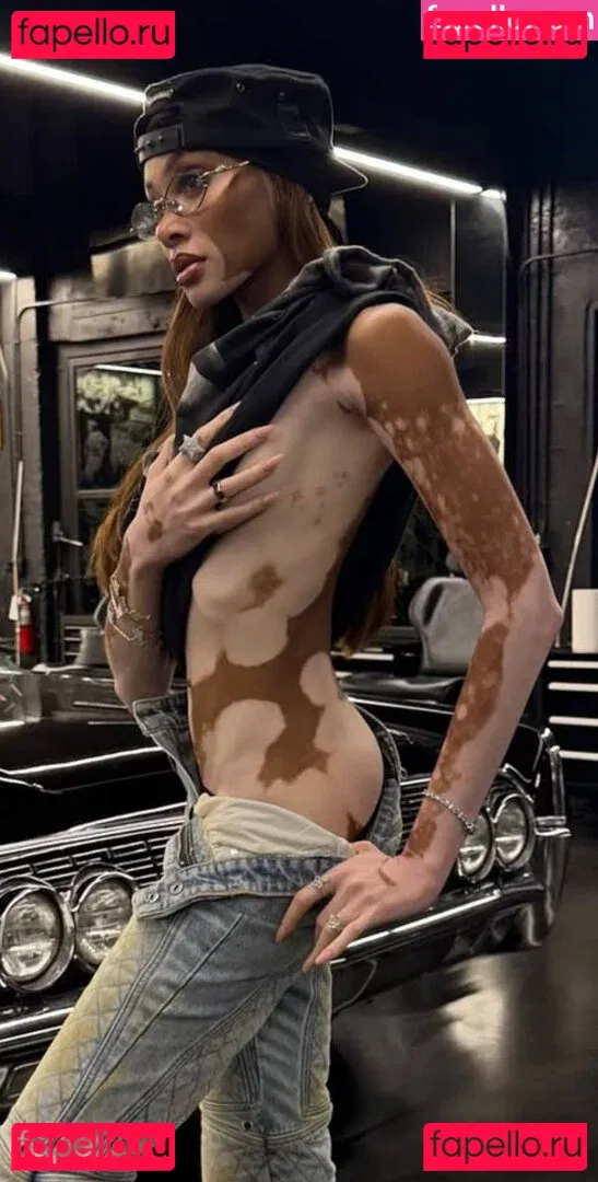 Winnie Harlow Onlyfans Photo Gallery 