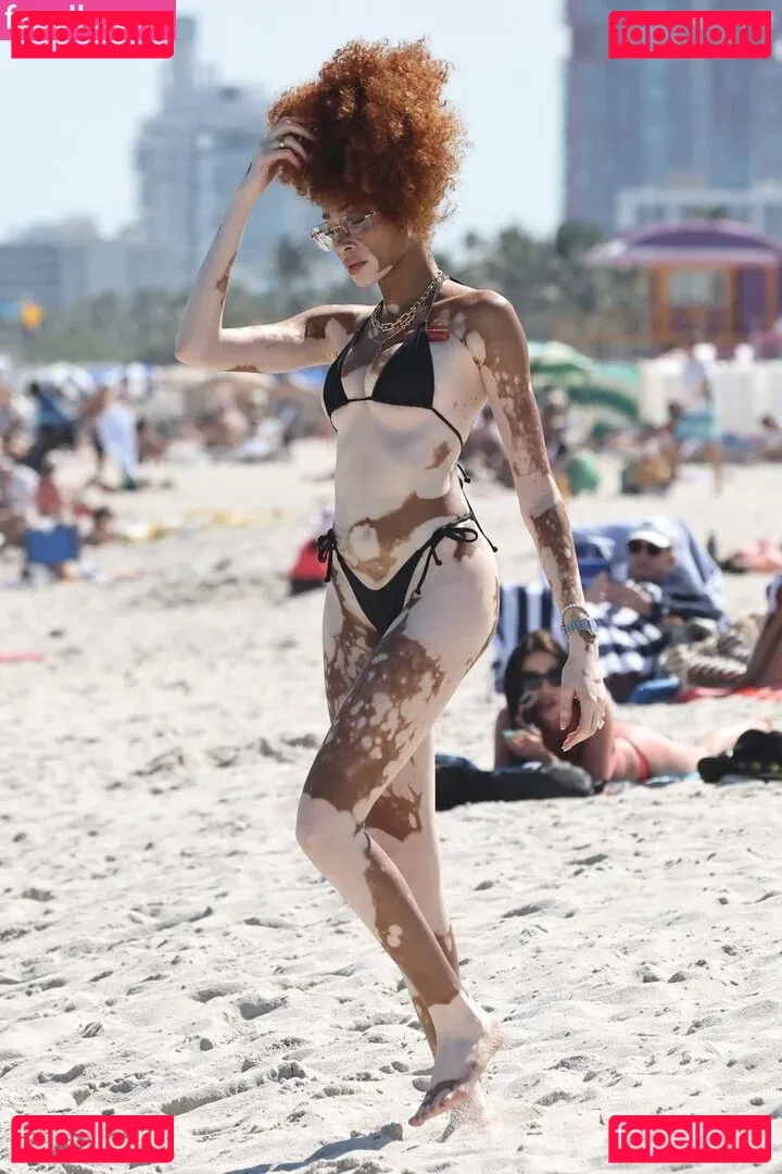 Winnie Harlow Onlyfans Photo Gallery 