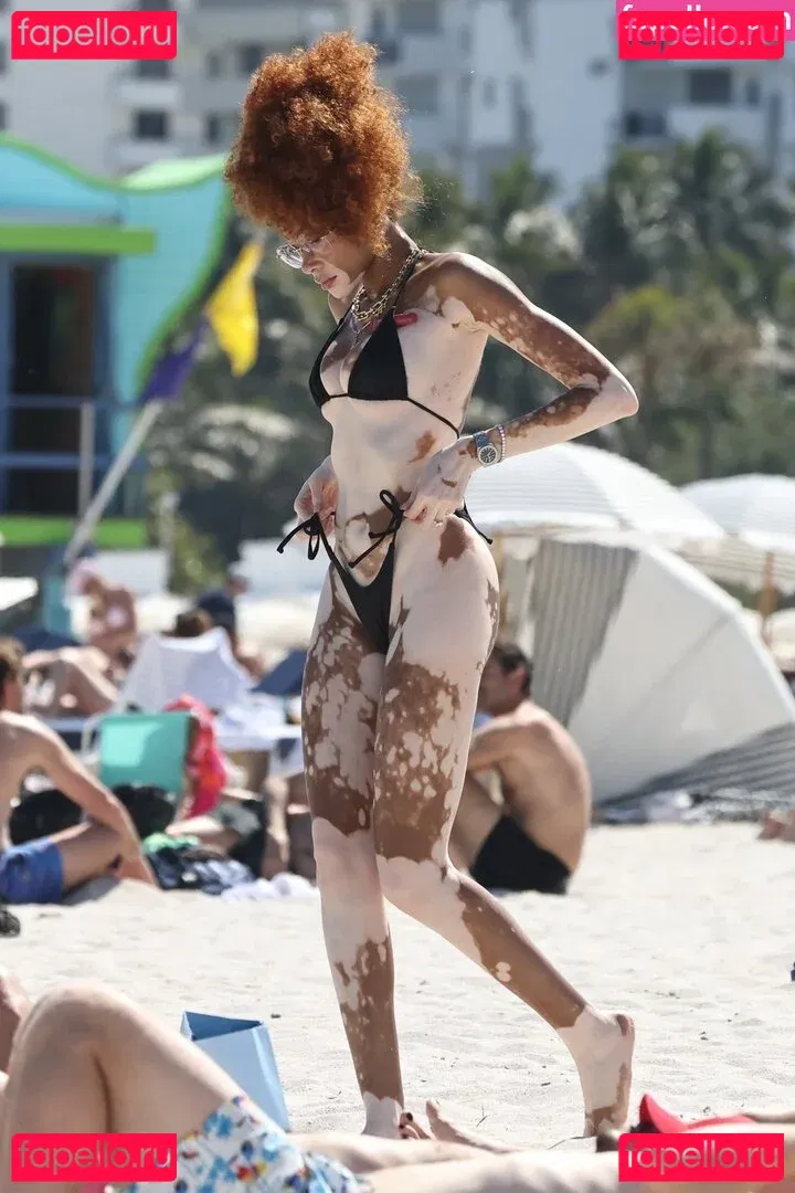 Winnie Harlow Onlyfans Photo Gallery 