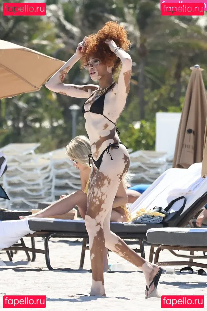 Winnie Harlow Onlyfans Photo Gallery 