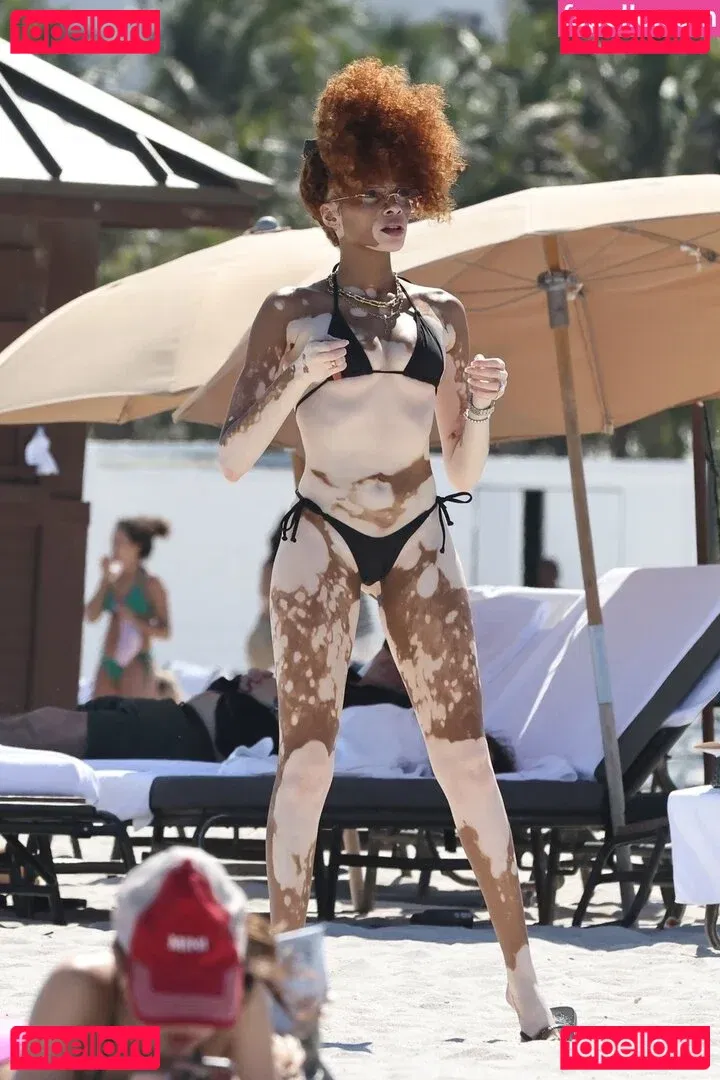 Winnie Harlow Onlyfans Photo Gallery 