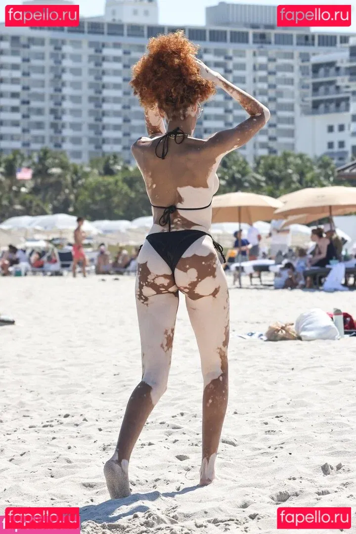 Winnie Harlow Onlyfans Photo Gallery 