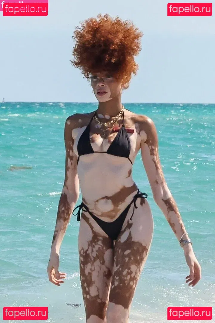 Winnie Harlow Onlyfans Photo Gallery 