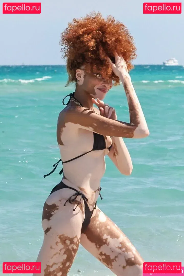 Winnie Harlow Onlyfans Photo Gallery 