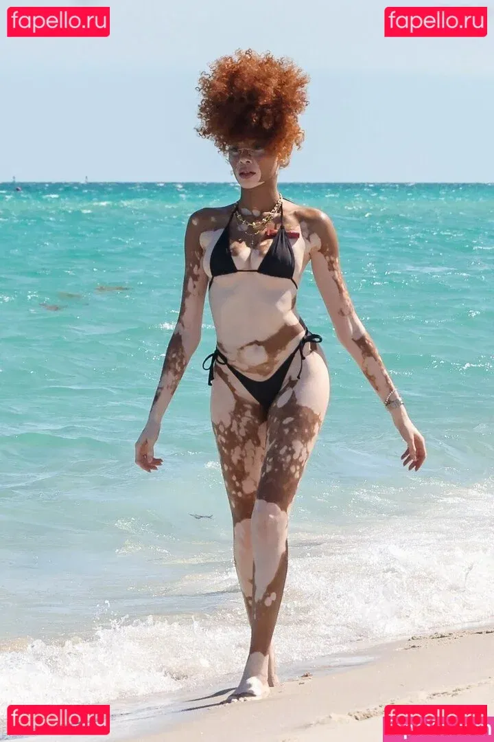 Winnie Harlow Onlyfans Photo Gallery 