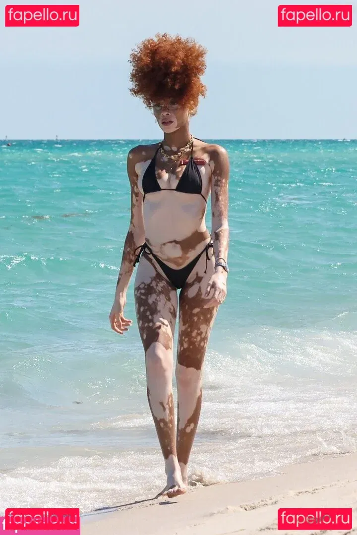 Winnie Harlow Onlyfans Photo Gallery 