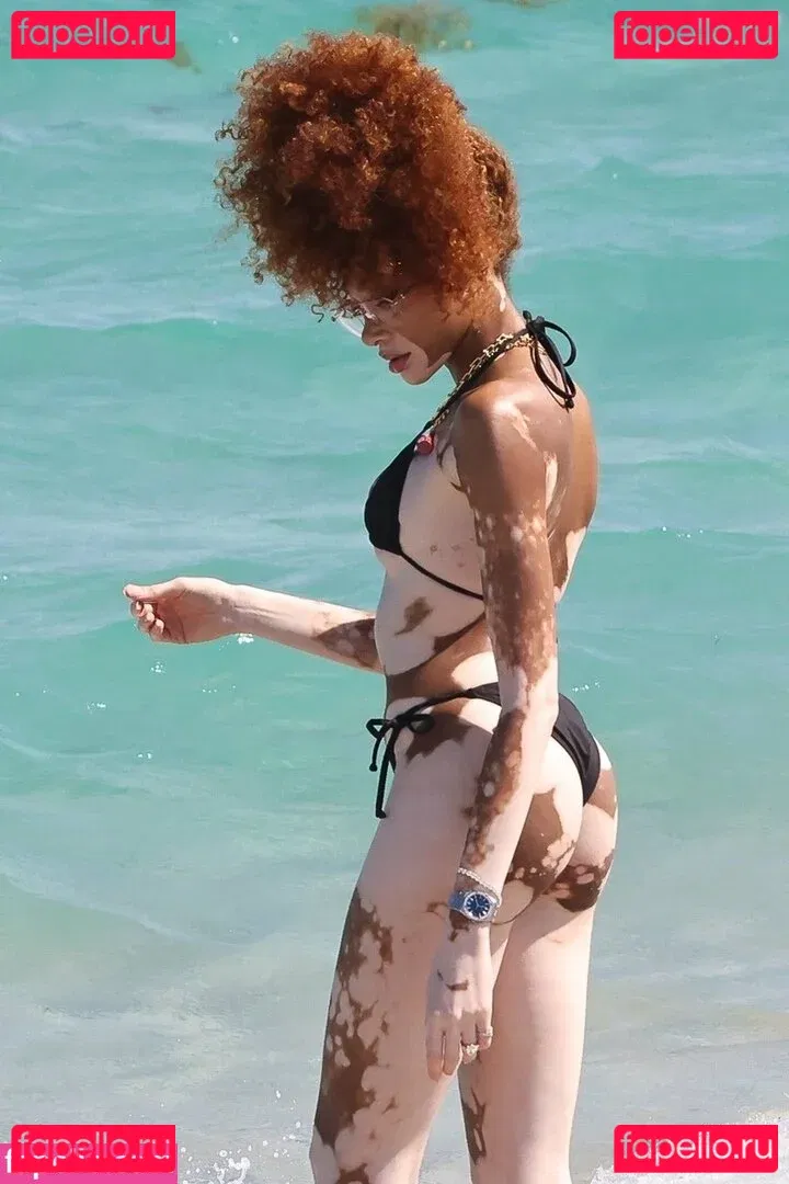 Winnie Harlow Onlyfans Photo Gallery 