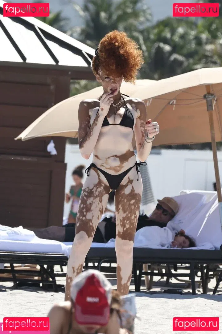 Winnie Harlow Onlyfans Photo Gallery 