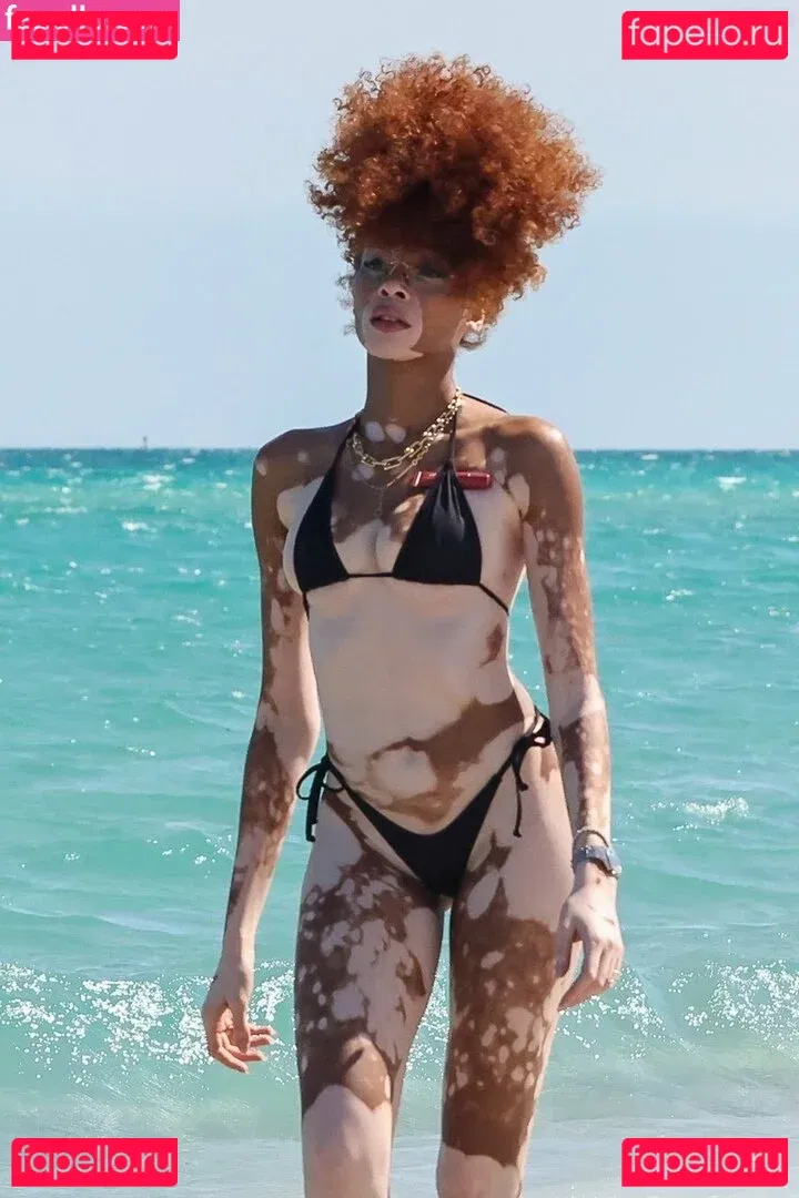 Winnie Harlow Onlyfans Photo Gallery 