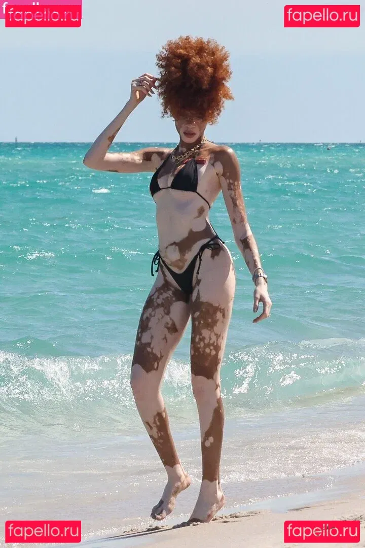 Winnie Harlow Onlyfans Photo Gallery 