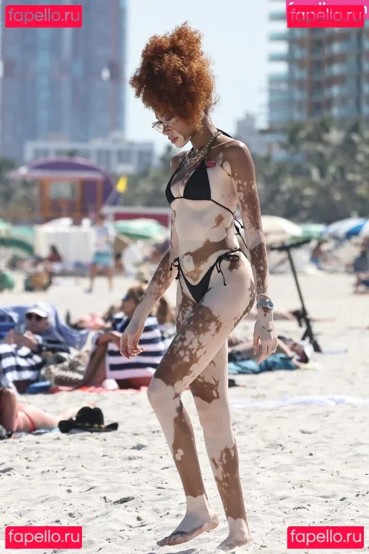 Winnie Harlow Onlyfans Photo Gallery 