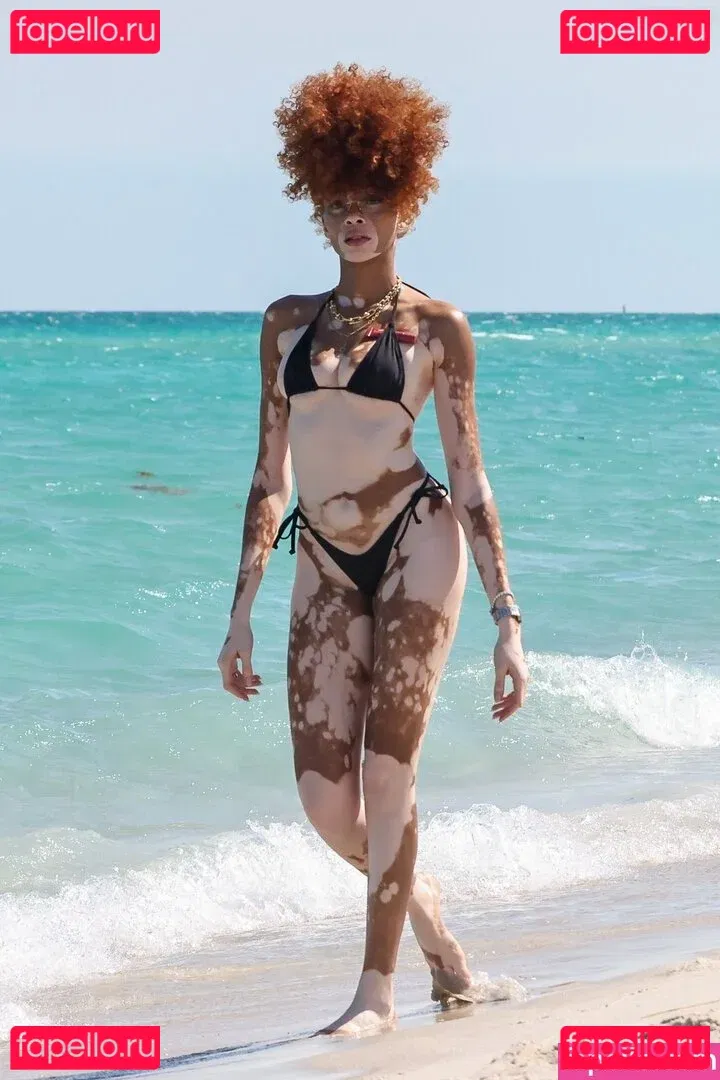 Winnie Harlow Onlyfans Photo Gallery 