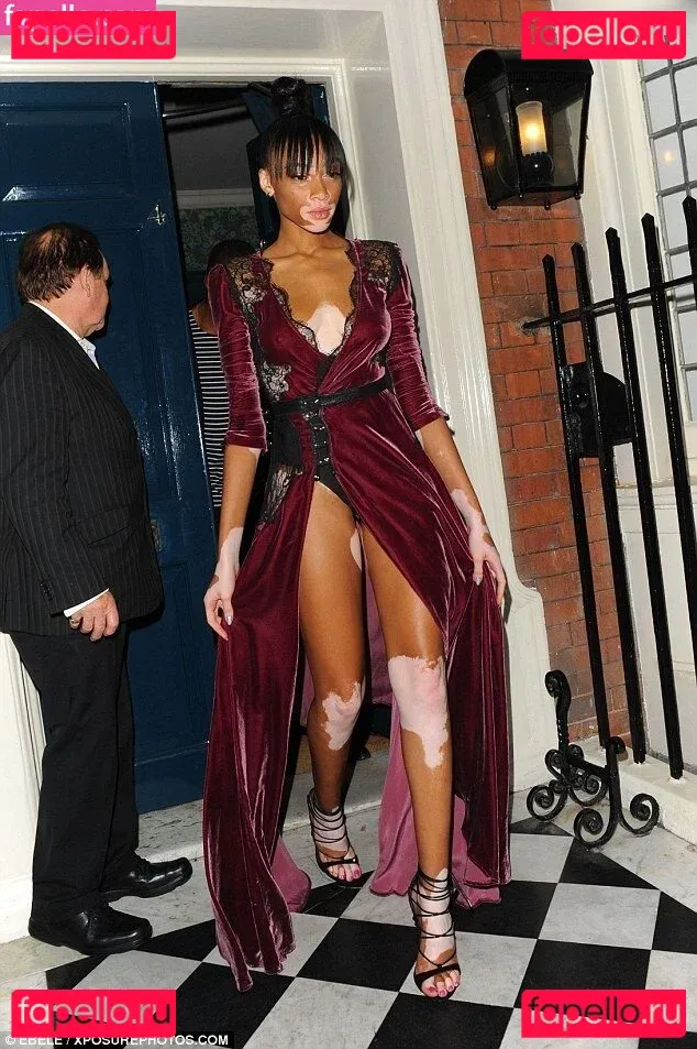 Winnie Harlow Onlyfans Photo Gallery 