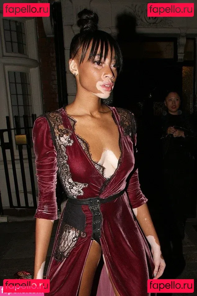 Winnie Harlow Onlyfans Photo Gallery 