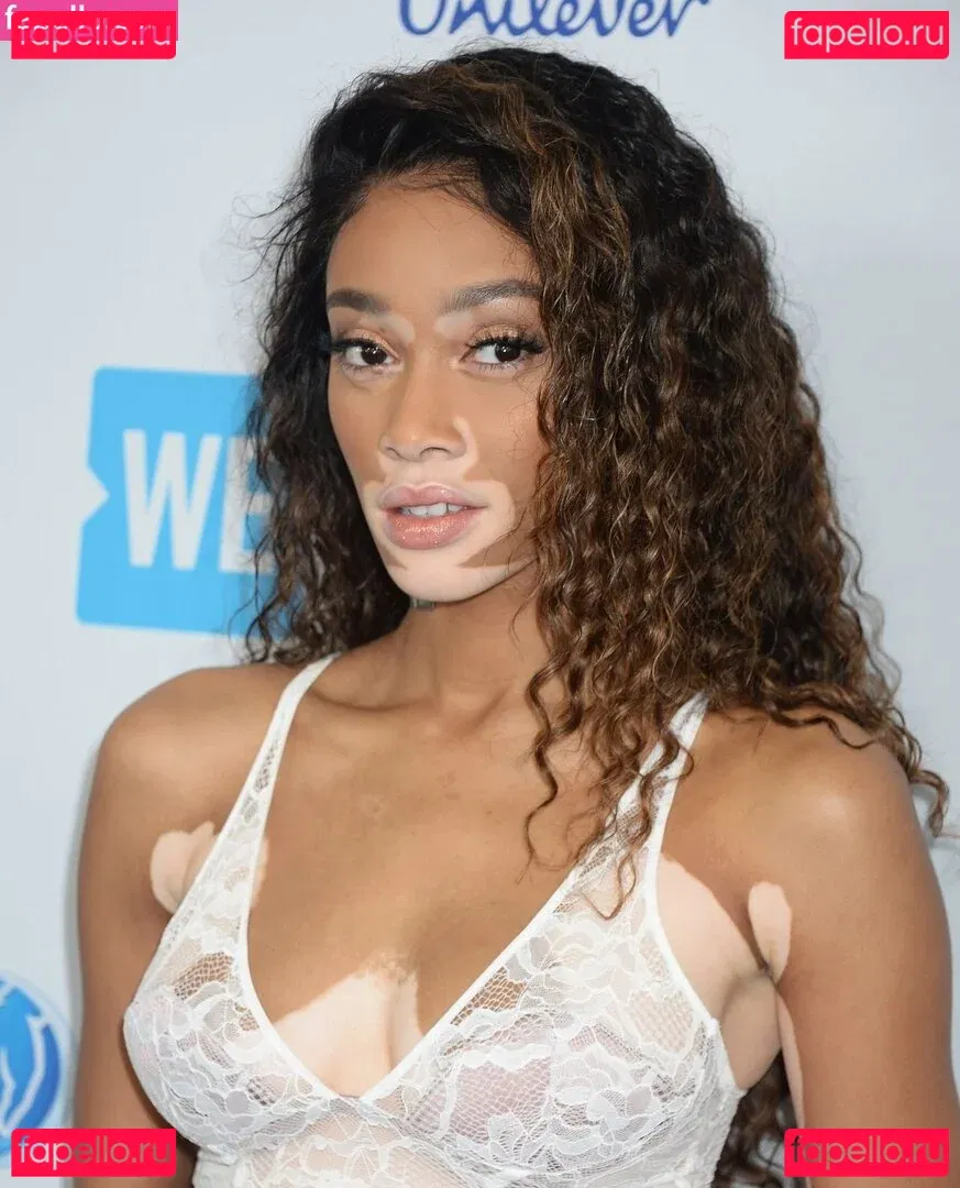 Winnie Harlow Onlyfans Photo Gallery 