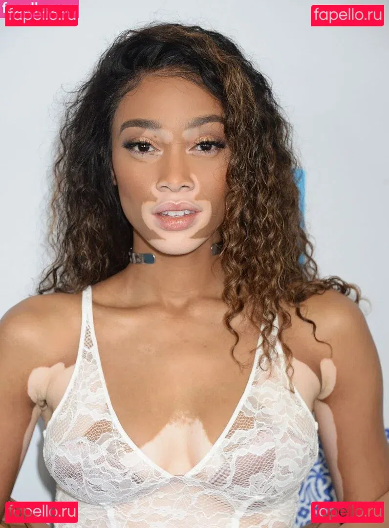 Winnie Harlow Onlyfans Photo Gallery 
