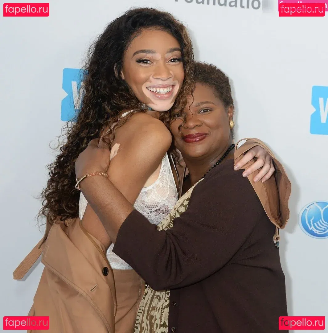 Winnie Harlow Onlyfans Photo Gallery 