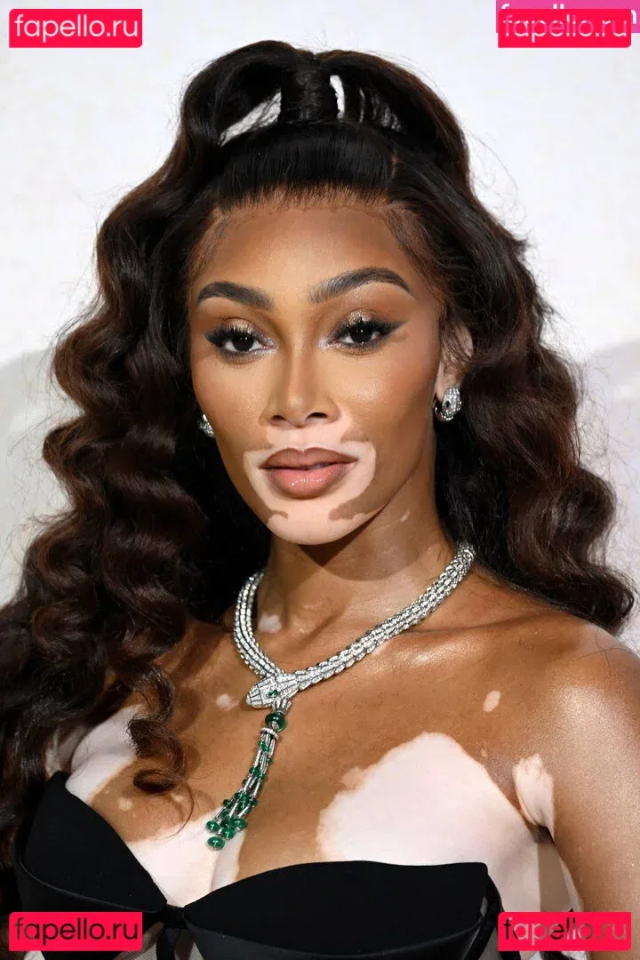 Winnie Harlow Onlyfans Photo Gallery 