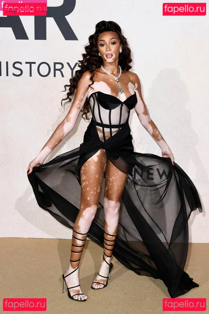 Winnie Harlow Onlyfans Photo Gallery 