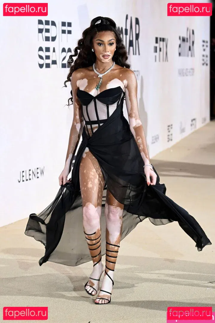 Winnie Harlow Onlyfans Photo Gallery 
