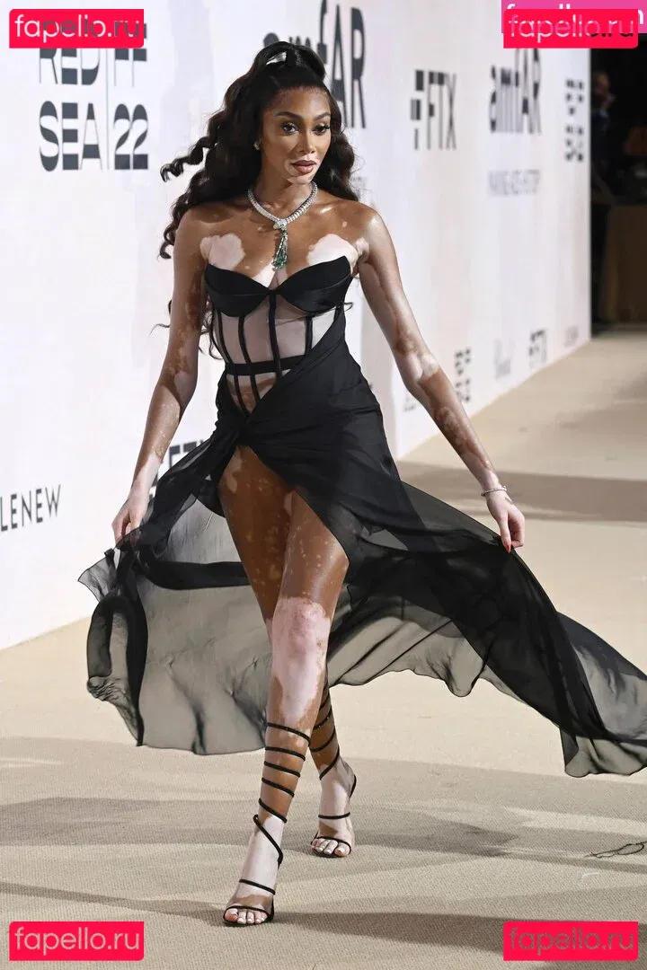 Winnie Harlow Onlyfans Photo Gallery 