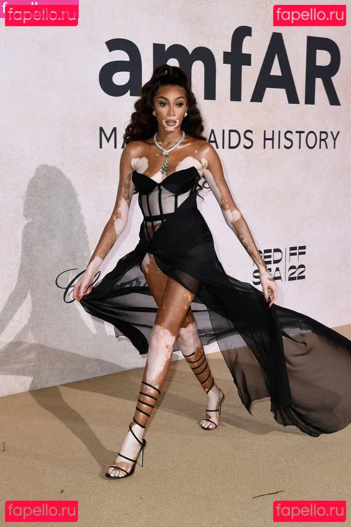 Winnie Harlow Onlyfans Photo Gallery 