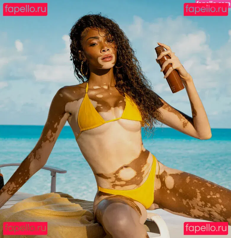Winnie Harlow Onlyfans Photo Gallery 