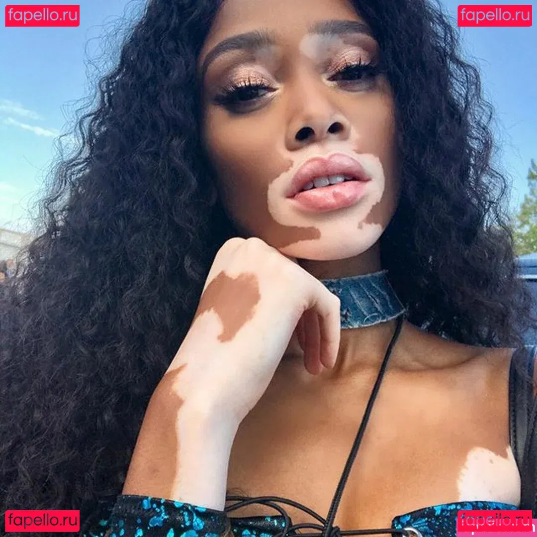 Winnie Harlow Onlyfans Photo Gallery 