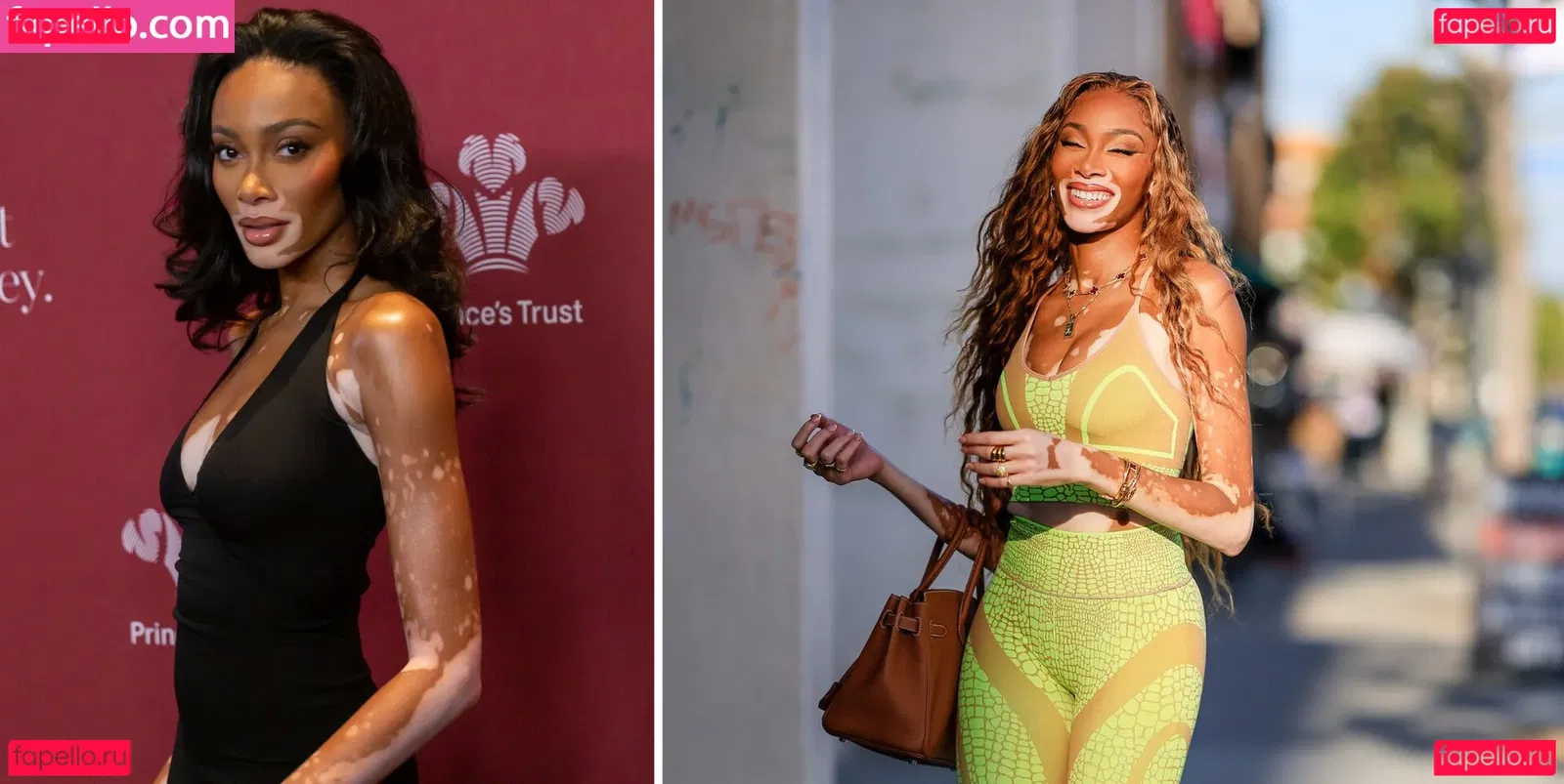 Winnie Harlow Onlyfans Photo Gallery 