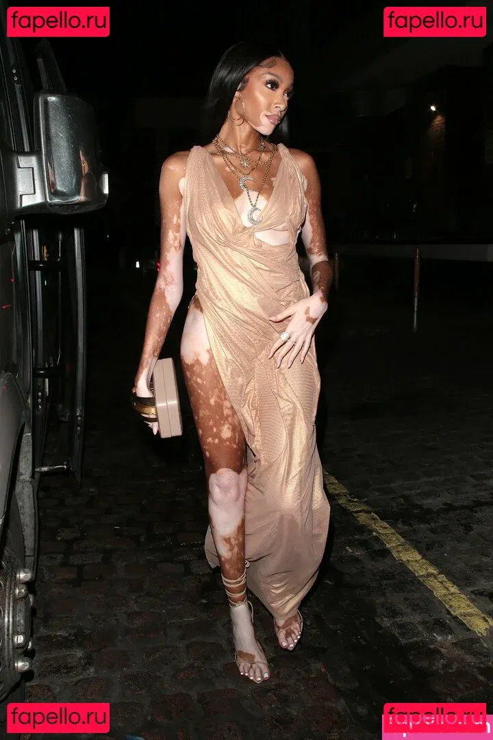 Winnie Harlow Onlyfans Photo Gallery 