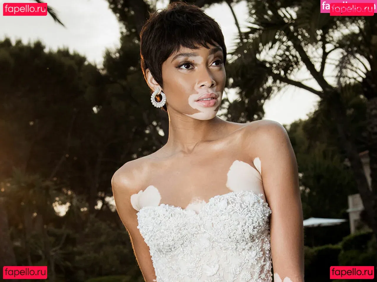 Winnie Harlow Onlyfans Photo Gallery 