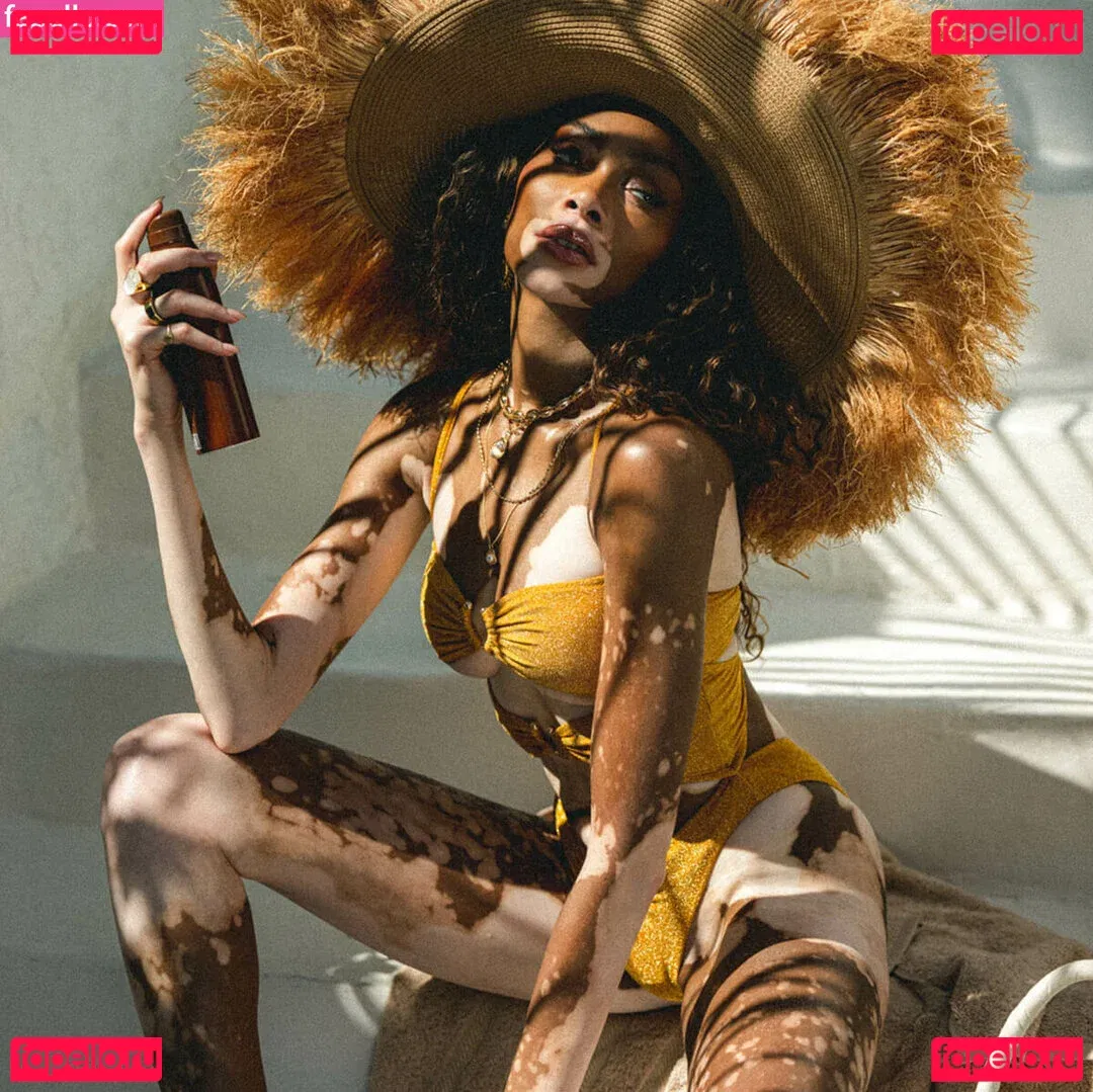 Winnie Harlow Onlyfans Photo Gallery 