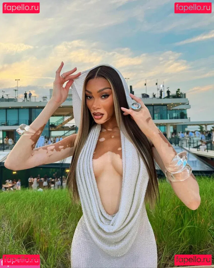 Winnie Harlow Onlyfans Photo Gallery 