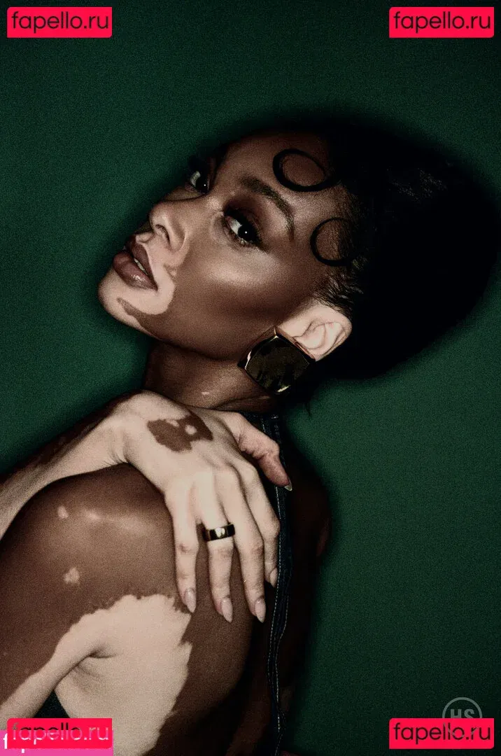 Winnie Harlow Onlyfans Photo Gallery 
